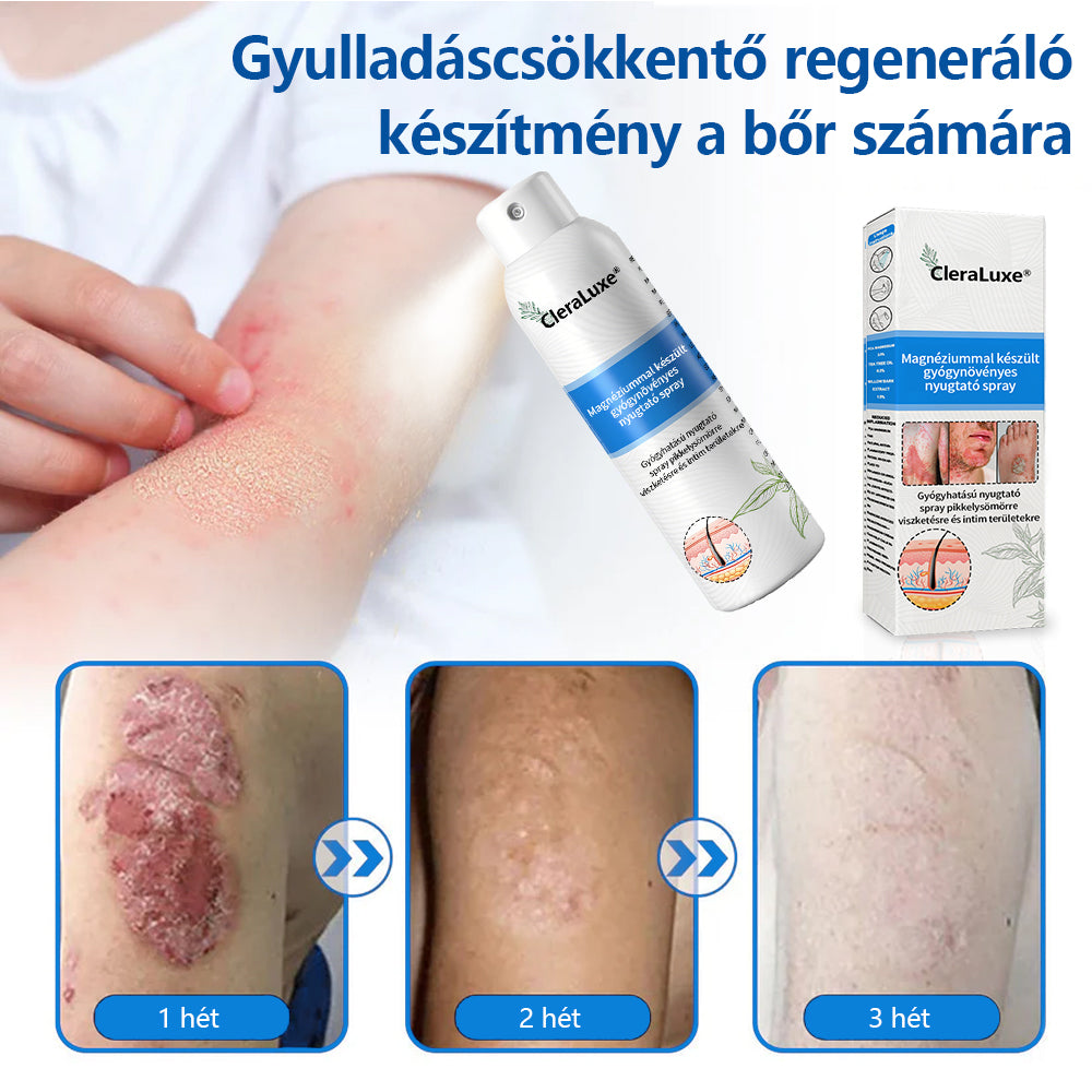 CleraLuxe®  Magnézium Gyógynövényes Pszoriázis Spray🌟🌟