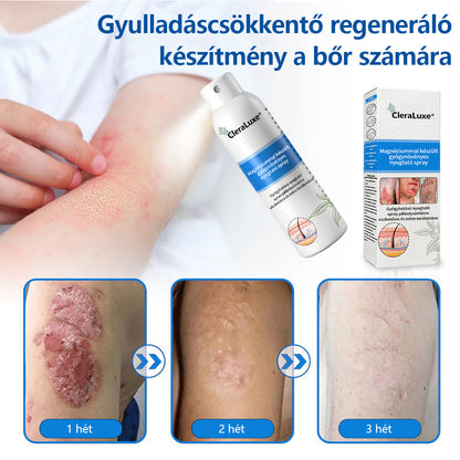 CleraLuxe®  Magnézium Gyógynövényes Pszoriázis Spray🌟🌟