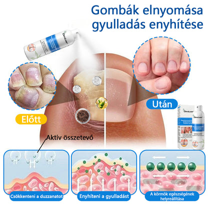 CleraLuxe®  Magnézium Gyógynövényes Pszoriázis Spray🌟🌟