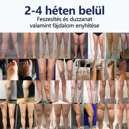 CleraLuxe® SwellRelief keringéstámogató krém🎁