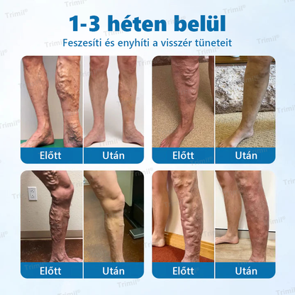 💚Trimil® VeinGuard Gyógynövényes Spray - ✅ Klinikailag bizonyított, hogy mindössze 7 nap alatt megszünteti a visszereket!✅