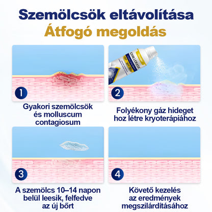 Timnlik® ChillErase pattanásmegújító spray🔥