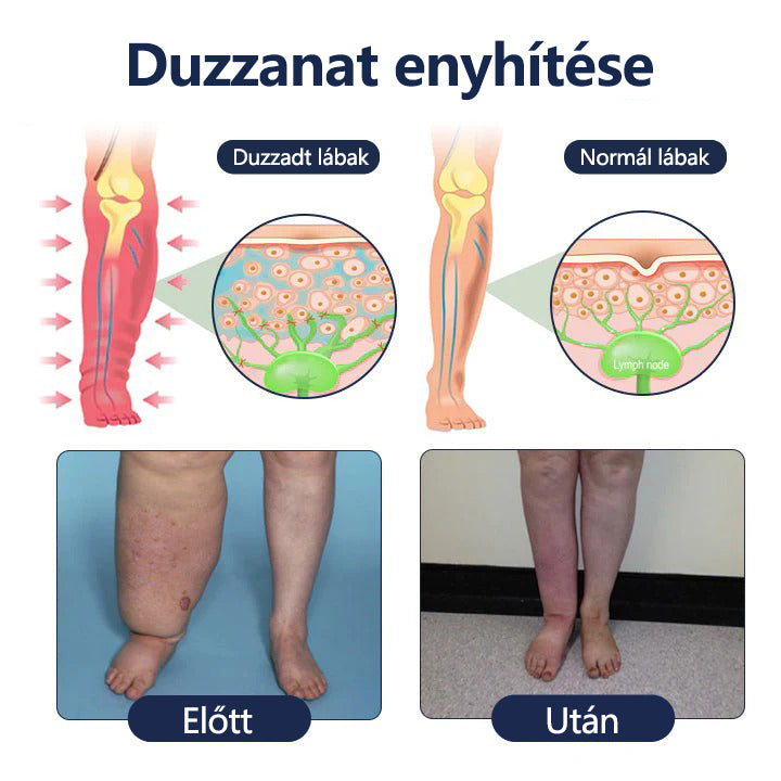 CleraLuxe® SwellRelief keringéstámogató krém🎁