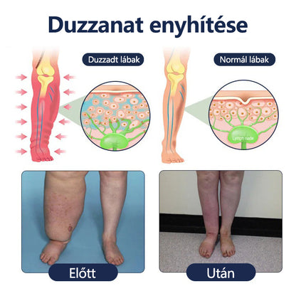 CleraLuxe® SwellRelief keringéstámogató krém🎁