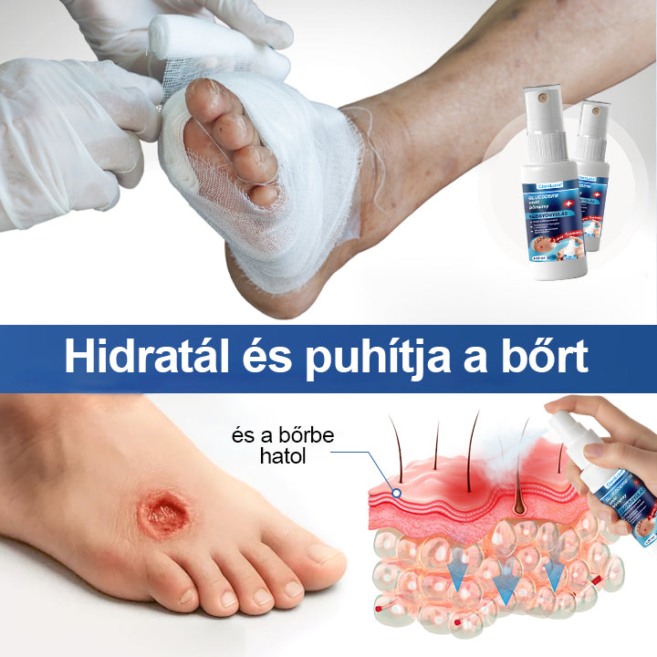 CleraLuxe® GlucoDerm lábvédő spray🔥