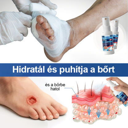 CleraLuxe® GlucoDerm lábvédő spray🔥