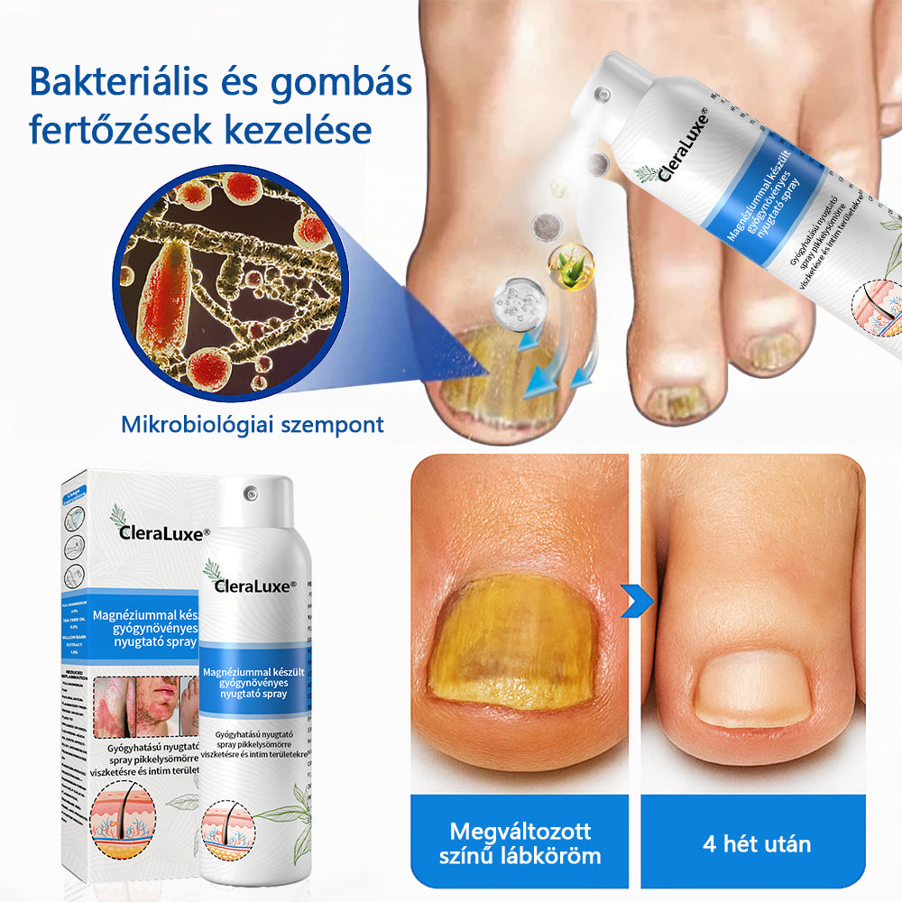 CleraLuxe®  Magnézium Gyógynövényes Pszoriázis Spray🌟🌟